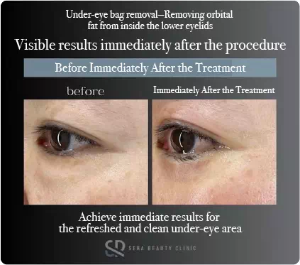 Achieve immediate results for the refreshed and clean under-eye area
