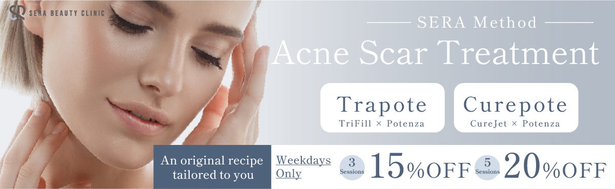 Acne Scar Treatment