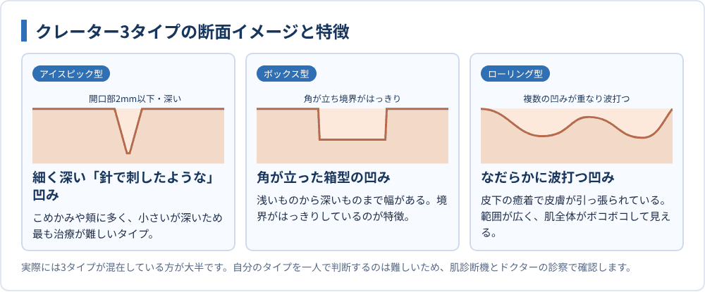 クレーター3タイプの断面イメージと特徴