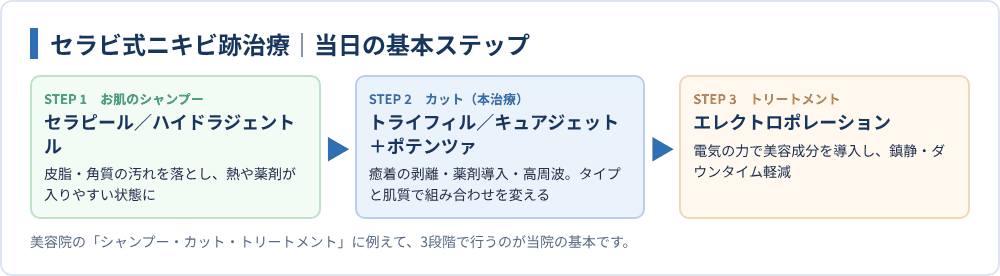 セラビ式ニキビ跡治療|当日の基本ステップ