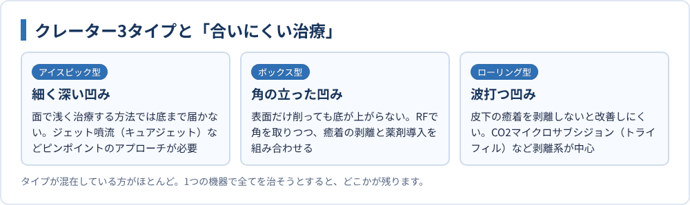 クレーター3タイプと「合いにくい治療」