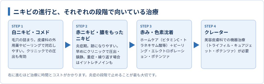 ニキビの進行と、それぞれの段階で向いている治療