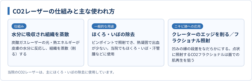 CO2レーザーの仕組みと主な使われ方
