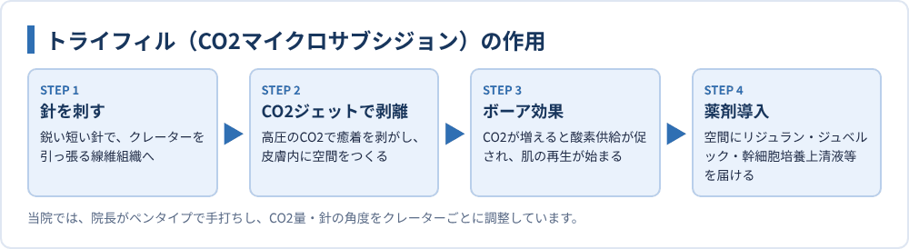 トライフィル（CO2マイクロサブシジョン）の作用