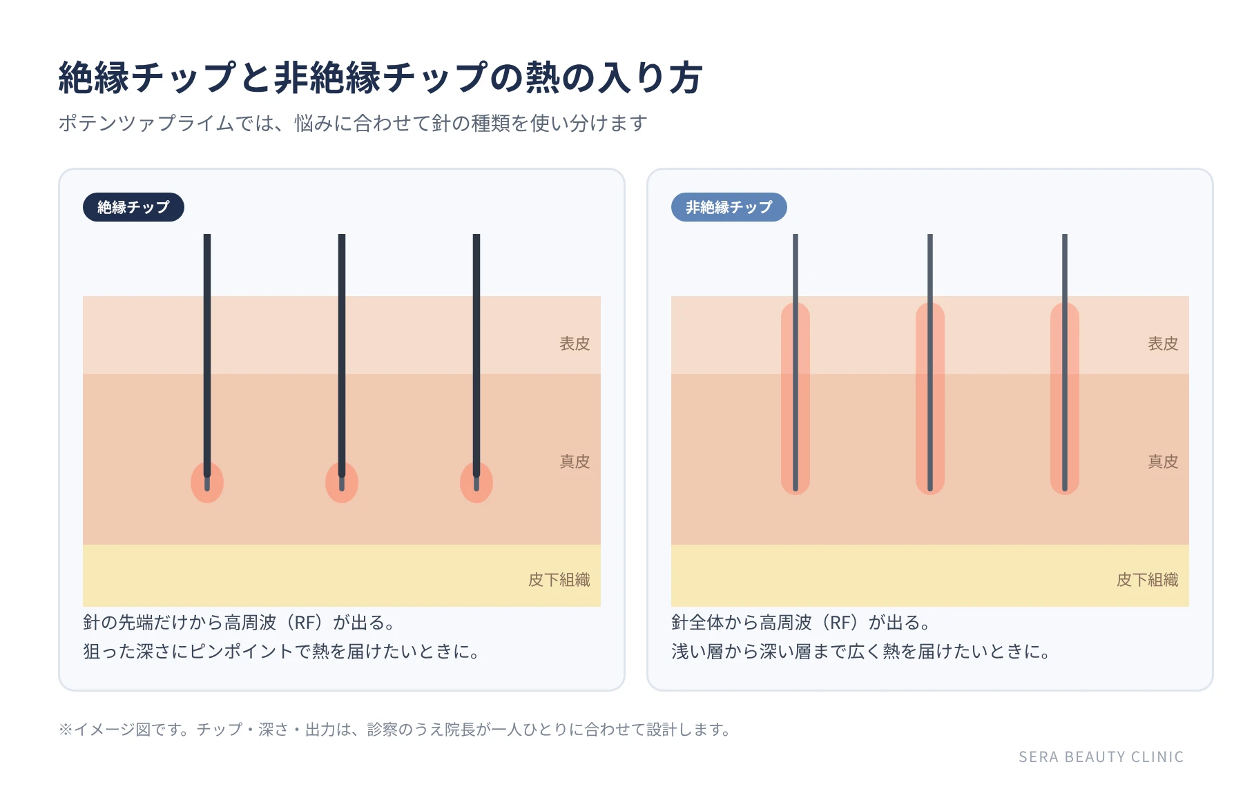 絶縁チップと非絶縁チップの熱の入り方