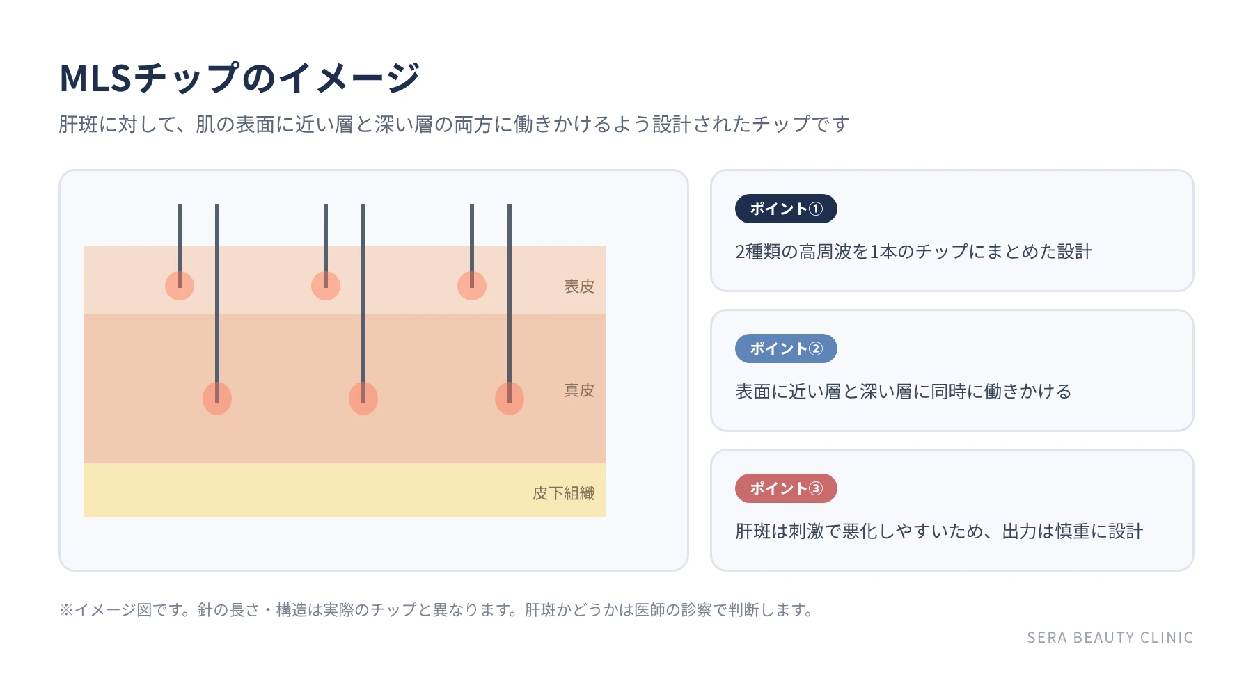 MLSチップのイメージ
